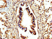 IHC image of CSB-PA006186LA01HU diluted at 1:300 and staining in paraffin-embedded human lung tissue performed on a Leica BondTM system. After dewaxing and hydration, antigen retrieval was mediated by high pressure in a citrate buffer (pH 6.0). Se...