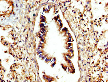 IHC image of CSB-PA006186LA01HU diluted at 1:300 and staining in paraffin-embedded human lung tissue performed on a Leica BondTM system. After dewaxing and hydration, antigen retrieval was mediated by high pressure in a citrate buffer (pH 6.0). Se...