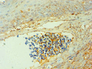 Immunohistochemistry of paraffin-embedded human tonsil tissue using CSB-PA006190ESR2HU at dilution of 1:100