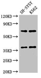 Western Blot Positive WB detected in: SH-SY5Y whole cell lysate, K562 whole cell lysate All lanes: CTSH antibody at 2.7µg/ml Secondary Goat polyclonal to rabbit IgG at 1/50000 dilution Predicted band size: 38 kDa Observed band size: 38 kDa