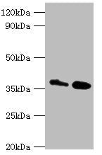 Western blot All lanes: CTSK antibody at 8ug/ml Lane 1: MCF-7 whole cell lysate Lane 2: Rat brain tissue Secondary Goat polyclonal to rabbit IgG at 1/10000 dilution Predicted band size: 37 kDa Observed band size: 37 kDa