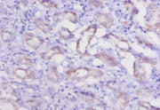 Immunohistochemistry of paraffin-embedded human kidney tissue using CSB-PA006192LA01RA at dilution of 1:20