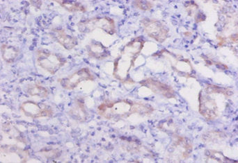 Immunohistochemistry of paraffin-embedded human kidney tissue using CSB-PA006192LA01RA at dilution of 1:20