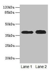 Western blot All lanes: CTSL antibody at 12µg/ml Lane 1: A549 whole cell lysate Lane 2: HepG2 whole cell lysate Secondary Goat polyclonal to rabbit IgG at 1/10000 dilution Predicted band size: 38 kDa Observed band size: 38 kDa