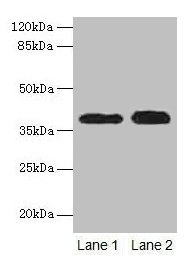 Western blot All lanes: CTSL antibody at 12µg/ml Lane 1: A549 whole cell lysate Lane 2: HepG2 whole cell lysate Secondary Goat polyclonal to rabbit IgG at 1/10000 dilution Predicted band size: 38 kDa Observed band size: 38 kDa