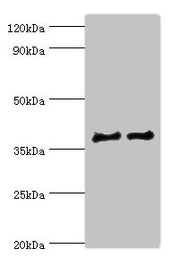 Western blot All lanes: CTSV antibody at 12ug/ml Lane 1: Jurkat whole cell lysate Lane 2: MCF-7 whole cell lysate Secondary Goat polyclonal to rabbit IgG at 1/10000 dilution Predicted band size: 37 kDa Observed band size: 37 kDa