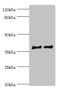 Western blot All lanes: CTSV antibody at 12ug/ml Lane 1: Jurkat whole cell lysate Lane 2: MCF-7 whole cell lysate Secondary Goat polyclonal to rabbit IgG at 1/10000 dilution Predicted band size: 37 kDa Observed band size: 37 kDa
