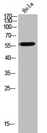 Western Blot analysis of Hela cells using CD39 Polyclonal Antibody