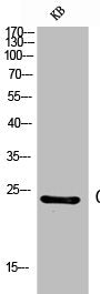 Western Blot analysis of KB cells using CD53 Polyclonal Antibody