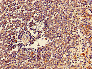Immunohistochemistry of paraffin-embedded human spleen tissue using CSB-PA006206LA01HU at dilution of 1:100