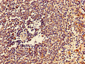 Immunohistochemistry of paraffin-embedded human spleen tissue using CSB-PA006206LA01HU at dilution of 1:100