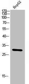 Western Blot analysis of HEPG2 cells using CD66c/d Polyclonal Antibody