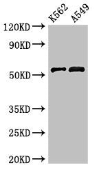 Western Blot Positive WB detected in: K562 whole cell lysate, A549 whole cell lysate All lanes: CELF2 antibody at 3µg/ml Secondary Goat polyclonal to rabbit IgG at 1/50000 dilution Predicted band size: 55, 53, 56 kDa Observed band size: 55 kDa