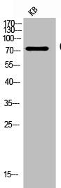 Western Blot analysis of KB cells using CD93 Polyclonal Antibody