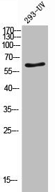 Western Blot analysis of 293-UV cells using CD96 Polyclonal Antibody