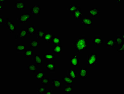 Immunofluorescence staining of Hela cells with CSB-PA006228LA01HU at 1:100, counter-stained with DAPI. The cells were fixed in 4% formaldehyde, permeabilized using 0.2% Triton X-100 and blocked in 10% normal Goat Serum. The cells were then incubat...