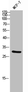 Western Blot analysis of MCF-7 cells using ICAM-2 Polyclonal Antibody