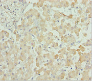 Immunohistochemistry of paraffin-embedded human liver tissue using CSB-PA006244ESR2HU at dilution of 1:100