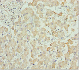 Immunohistochemistry of paraffin-embedded human liver tissue using CSB-PA006244ESR2HU at dilution of 1:100