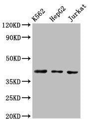 Western Blot Positive WB detected in: K562 whole cell lysate, HepG2 whole cell lysate, Jurkat whole cell lysate All lanes: CXCR3 antibody at 3ug/ml Secondary Goat polyclonal to rabbit IgG at 1/50000 dilution Predicted band size: 41, 46, 29 kDa Obs...
