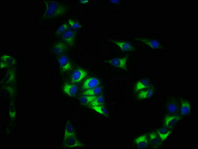 Immunofluorescence staining of Hela cells with CSB-PA006254YA01HU at 1:200, counter-stained with DAPI. The cells were fixed in 4% formaldehyde, permeabilized using 0.2% Triton X-100 and blocked in 10% normal Goat Serum. The cells were then incubat...