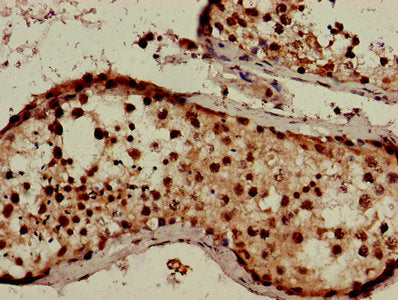 Immunohistochemistry of paraffin-embedded human testis tissue using CSB-PA006258LA01HU at dilution of 1:100