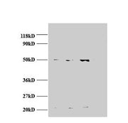 Western blot All lanes: AP2M1 antibody at 2µg/ml Lane 1: Jurket whole cell lysate Lane 2: U87 whole cell lysate Lane 3: U251 whole cell lysate Secondary Goat polyclonal to rabbit IgG at 1/15000 dilution Predicted band size: 50 kDa Observed band si...