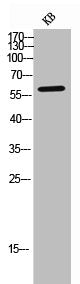 Western Blot analysis of KB cells using IL-9R Polyclonal Antibody
