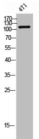 Western Blot analysis of 4T1 cells using Flt3 Polyclonal Antibody