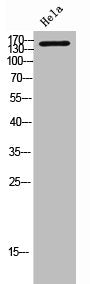 Western Blot analysis of Hela cells using Ron α Polyclonal Antibody