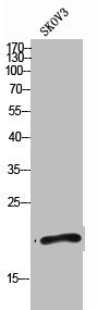 Western Blot analysis of SKOV3 cells using BST-2 Polyclonal Antibody