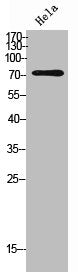 Western Blot analysis of Hela cells using IL-12Rβ1 Polyclonal Antibody