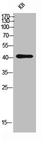 Western Blot analysis of KB cells using CD244 Polyclonal Antibody