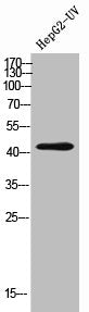 Western Blot analysis of HEPG2-UV cells using IL-13Rα2 Polyclonal Antibody