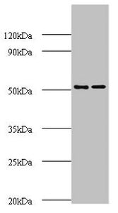 Western blot All lanes: AP-2 complex subunit mu polyclonal Antibody at 2ug/ml Lane 1: Mouse brain tissue Lane 2: Rat brain tissue Secondary Goat polyclonal to rabbit IgG at 1/10000 dilution Predicted band size: 50 kDa Observed band size: 50 kDa