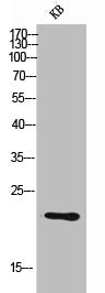 Western Blot analysis of KB cells using Ox40L Polyclonal Antibody