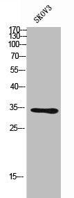 Western Blot analysis of SKOV3 cells using NKp46 Polyclonal Antibody