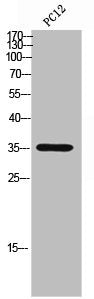 Western Blot analysis of PC12 cells using CD298 Polyclonal Antibody
