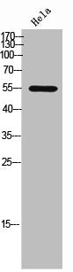 Western Blot analysis of Hela cells using SIRP-α1/β1 Polyclonal Antibody