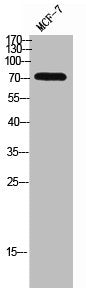 Western Blot analysis of MCF-7 cells using EMR2 Polyclonal Antibody