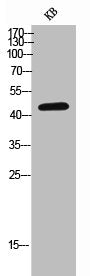 Western Blot analysis of KB cells using CD155 Polyclonal Antibody