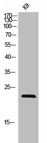 Western Blot analysis of KB cells using NKp30 Polyclonal Antibody