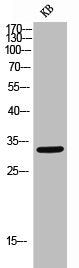 Western Blot analysis of KB cells using CD305 Polyclonal Antibody