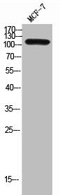Western Blot analysis of MCF-7 cells using CD249 Polyclonal Antibody