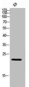Western Blot analysis of KB cells using Lambda 5 Polyclonal Antibody