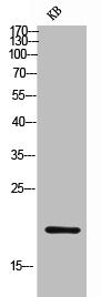 Western Blot analysis of KB cells using Probetacellulin Polyclonal Antibody