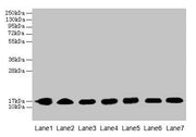 Western blot All lanes: CYB5B antibody at 0.8µg/ml Lane 1: HepG2 whole cell lysate Lane 2: Mouse liver tissue Lane 3: Mouse heart tissue Lane 4: Hela whole cell lysate Lane 5: U87 whole cell lysate Lane 6: EC109 whole cell lysate Lane 7: A549 whol...