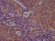 IHC image of CSB-PA006323LA01HU diluted at 1:200 and staining in paraffin-embedded human lymph node tissue performed on a Leica BondTM system. After dewaxing and hydration, antigen retrieval was mediated by high pressure in a citrate buffer (pH 6....