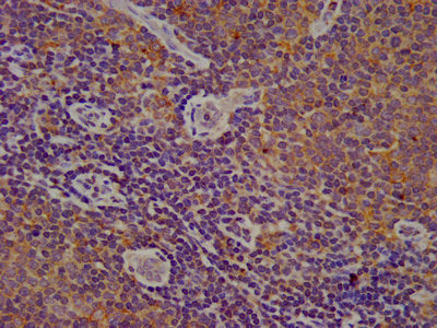 IHC image of CSB-PA006323LA01HU diluted at 1:200 and staining in paraffin-embedded human lymph node tissue performed on a Leica BondTM system. After dewaxing and hydration, antigen retrieval was mediated by high pressure in a citrate buffer (pH 6....