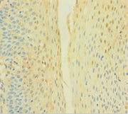 Immunohistochemistry of paraffin-embedded human tonsil tissue using CSB-PA006325LA01HU at dilution of 1:100